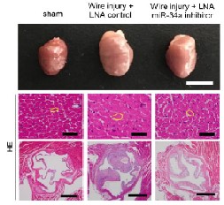 図２：マウス心臓の弁膜症に対するマイクロRNA-34a抑制の効果（Toshima T, et. al. Cardiovasc Res. 2020）の画像