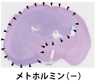 メトホルミン治療(－)：矢頭で囲まれた広い範囲が再発脳腫瘍の画像