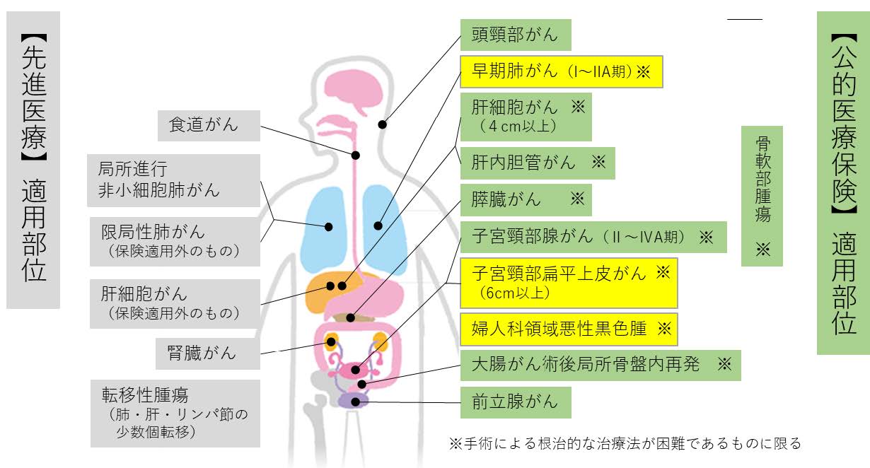 【６月１日以降の当院における重粒子線治療対象部位】の画像