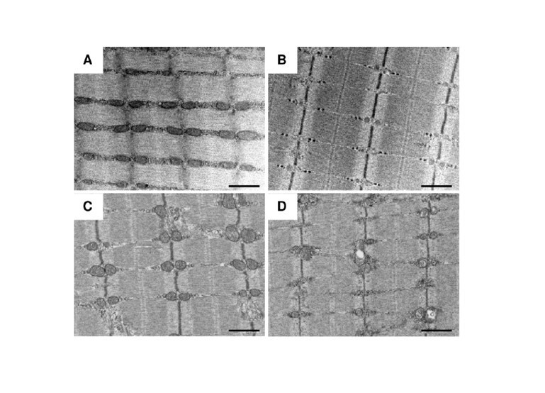 図2：ALAS1遺伝子破壊マウス骨格筋の萎縮したミトコンドリア(B)と5-ALA投与によるミトコンドリア異常の回復(D)（A:野生型マウス，C:5-ALA投与野生型マウス）の画像