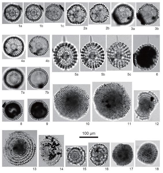 図8 軟質泥岩礫から産出した放散虫化石．
1–4. Haliometta miocenica (Campbell and Clark). 試料3.
5, 6. Axoprunum stauraxonium Haeckel. 試料3.
7–9. Cenosphaera sp. 試料3.
10. Spongodiscus sp. 試料3
11. Spongodiscus sp. 試料1.
12. Flustrella sp. 試料3.
13, 14. Stylodictya camerina Campbell and Clark? 試料3.
15, 16. Larcopyle spp. 試料3.
17. Spumellaria gen. et sp. indet. 試料1.
18. Spumellaria gen. et sp. indet. 試料3.の画像