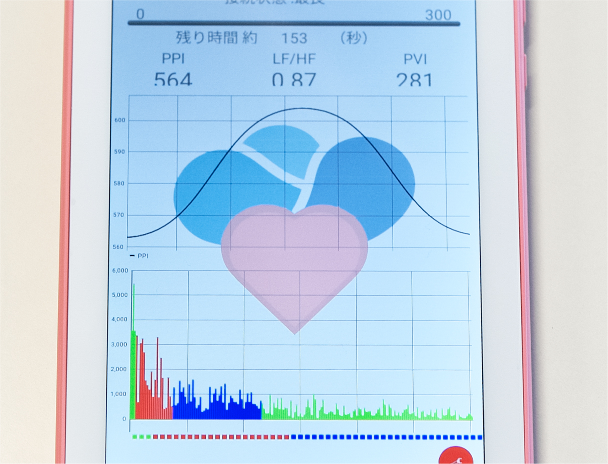 ストレス計測機の結果を表した画面の一例