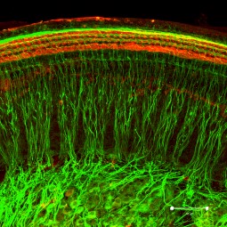 図2. 図1の拡大図（赤-有毛細胞、緑-聴神経）の画像