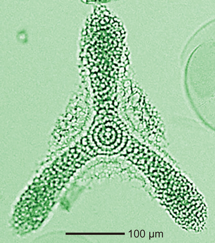 プランクトンの一種放散虫。ユーチトニアの光学顕微鏡写真。