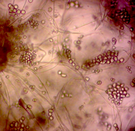ラ・フランスのデンプン（分子〜細胞）の画像