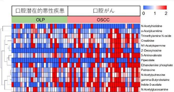 図２：口腔がん患者と口腔潜在的悪性疾患患者の唾液中代謝物のヒートマップの画像
