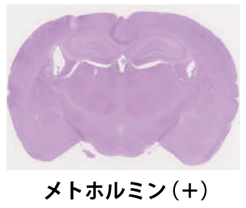 メトホルミン治療(＋)：再発腫瘍は認められないの画像