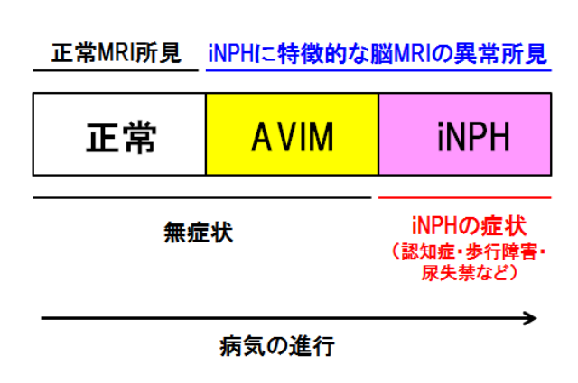 図4 特発性正常圧水頭症(iNPH)はAVIM(エイビム)の状態を経て発症する。<br>AVIM: asymptomatic ventriculomegaly with features of iNPH on MR
の画像