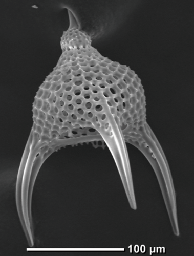 プランクトンの一種放散虫。プテロカニウムの電子顕微鏡写真。