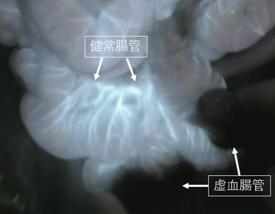 術中蛍光造影法を用いた腸管虚血診断 の画像